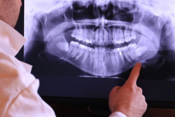 Best Emergency Gum Treatment in Amelia, OH