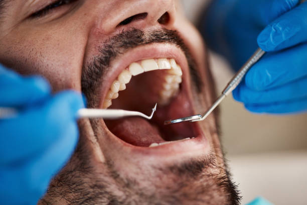 Best Emergency Treatment for Dental Infections or Abscesses in Amelia, OH