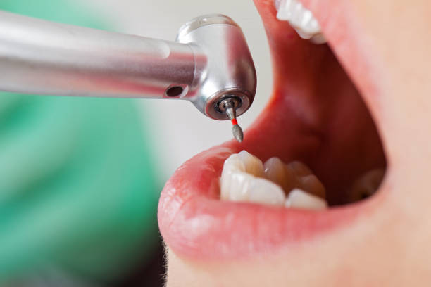 Best Pediatric Emergency Dentist in Amelia, OH
